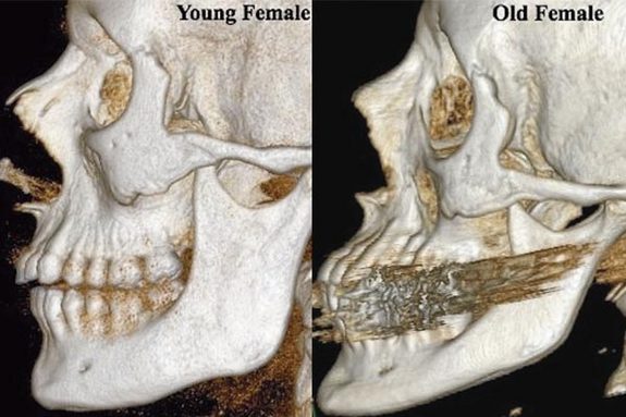 Transitional Fossils